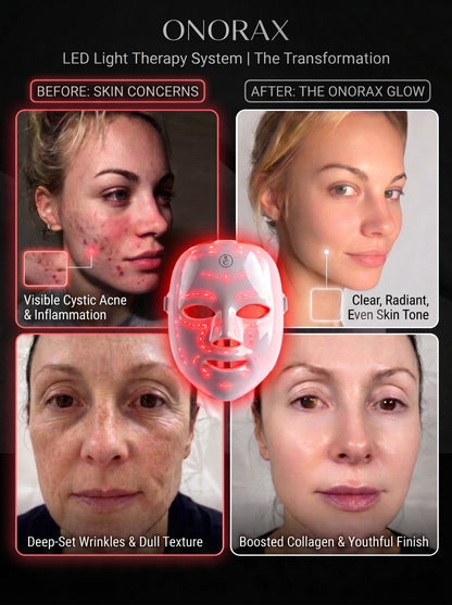 Onorax Led Light Therapy Mask